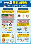 基孔肯雅熱防治知識(shí)