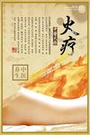 火疗