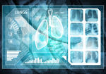 肺脏X光医疗信息背景图