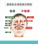 鼻炎海报