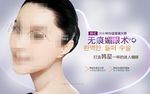 双眼皮