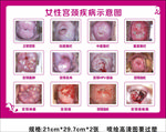 女性宫颈疾病示意图