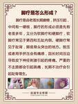 脚疔 脚疔展板 脚疔介绍