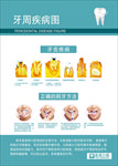 口腔医院挂图——牙周疾病图