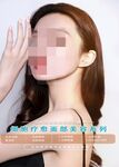 面部美容