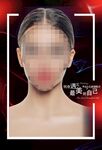 双眼皮