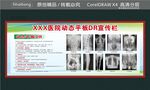 医院动态平板DR宣传栏