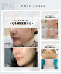 医美案例模板