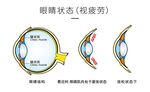 眼球结构图