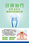 牙周治疗海报