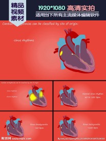 心律失常源站点分类动画演示