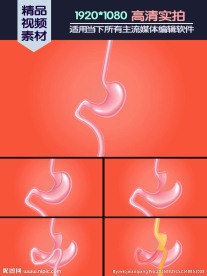 迷你胃旁路手术动画演示