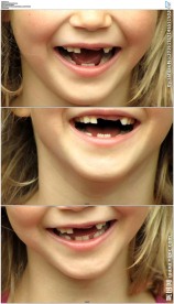 缺牙的金发小女孩微笑