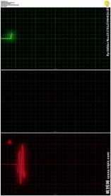 心电图跳动的心脏