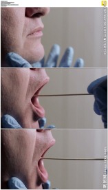 棉签擦嘴检验dna