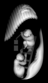 童子佛像精雕浮雕灰度