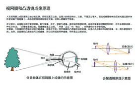 视网膜成像眼球成像凸透镜原理