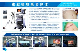 腹腔镜胆囊切除术