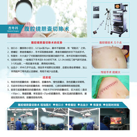 腹腔镜胆囊切除术