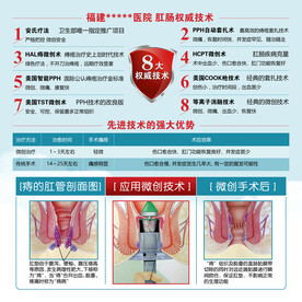 肛肠科权威技术