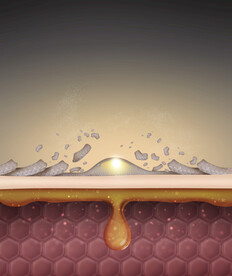 痘痘祛痘化妆品海报