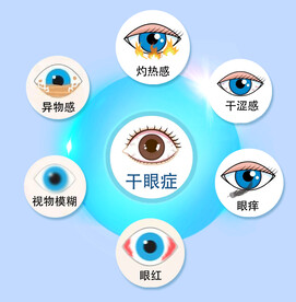 干眼症各种症状眼球结构示意图