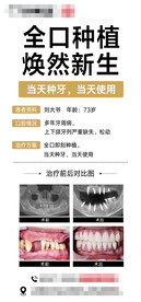 种植牙前后对比案例海报