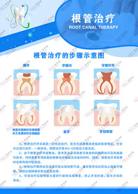根管治疗