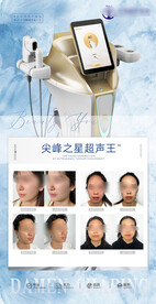 超声王灯箱海报