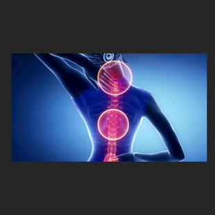 关节活动骨骼健康动画