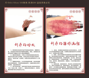 中医刮痧展板