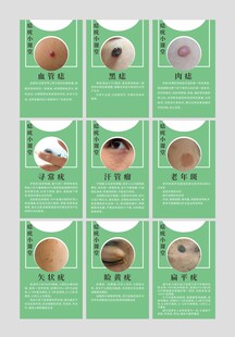 痣疣小课堂集合