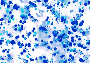 扎染乱点数码印花