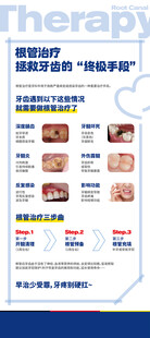 牙齿根管治疗科普